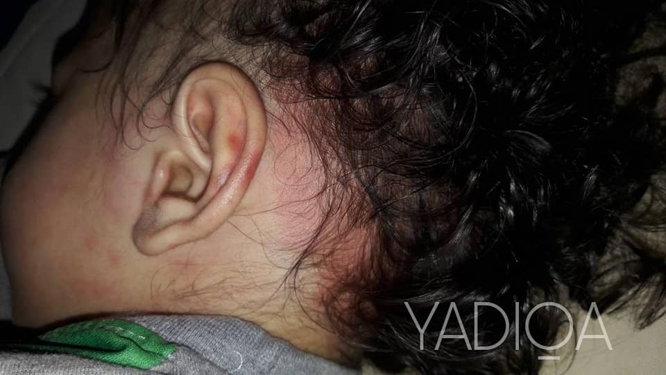 2 Minggu Hantar Pengasuh, Anak Di Syaki Di Dera. Jadi 