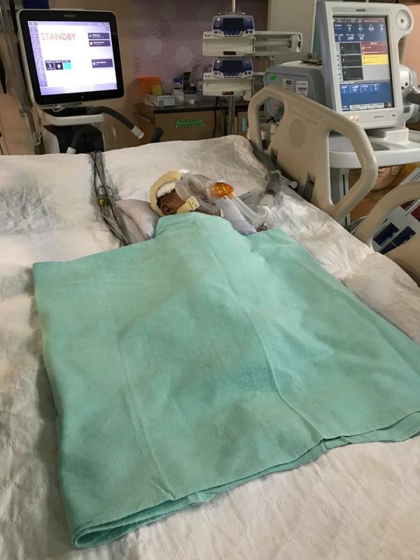 Akibat Batuk Berpanjangan Hingga Nafas Terhenti, Bayi 1 